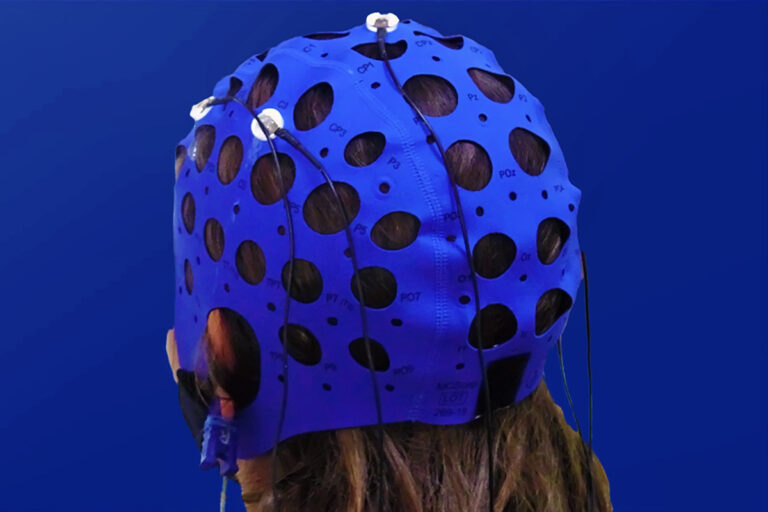 mini QEEG – analiza aktywności mózgu wykorzystywana w diagnostyce funkcjonowania układu nerwowego